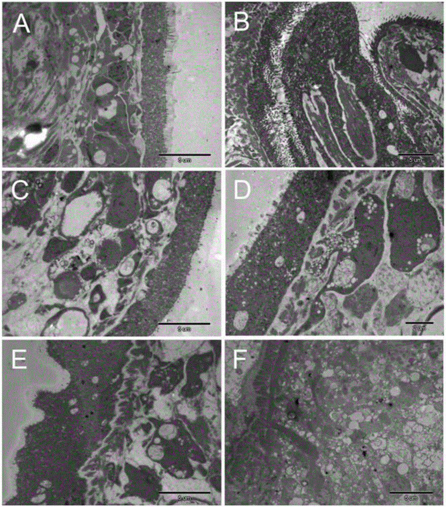 Application of ERK inhibitor PD98059 in preparation of medicine for treatment of alveolar hydatid disease