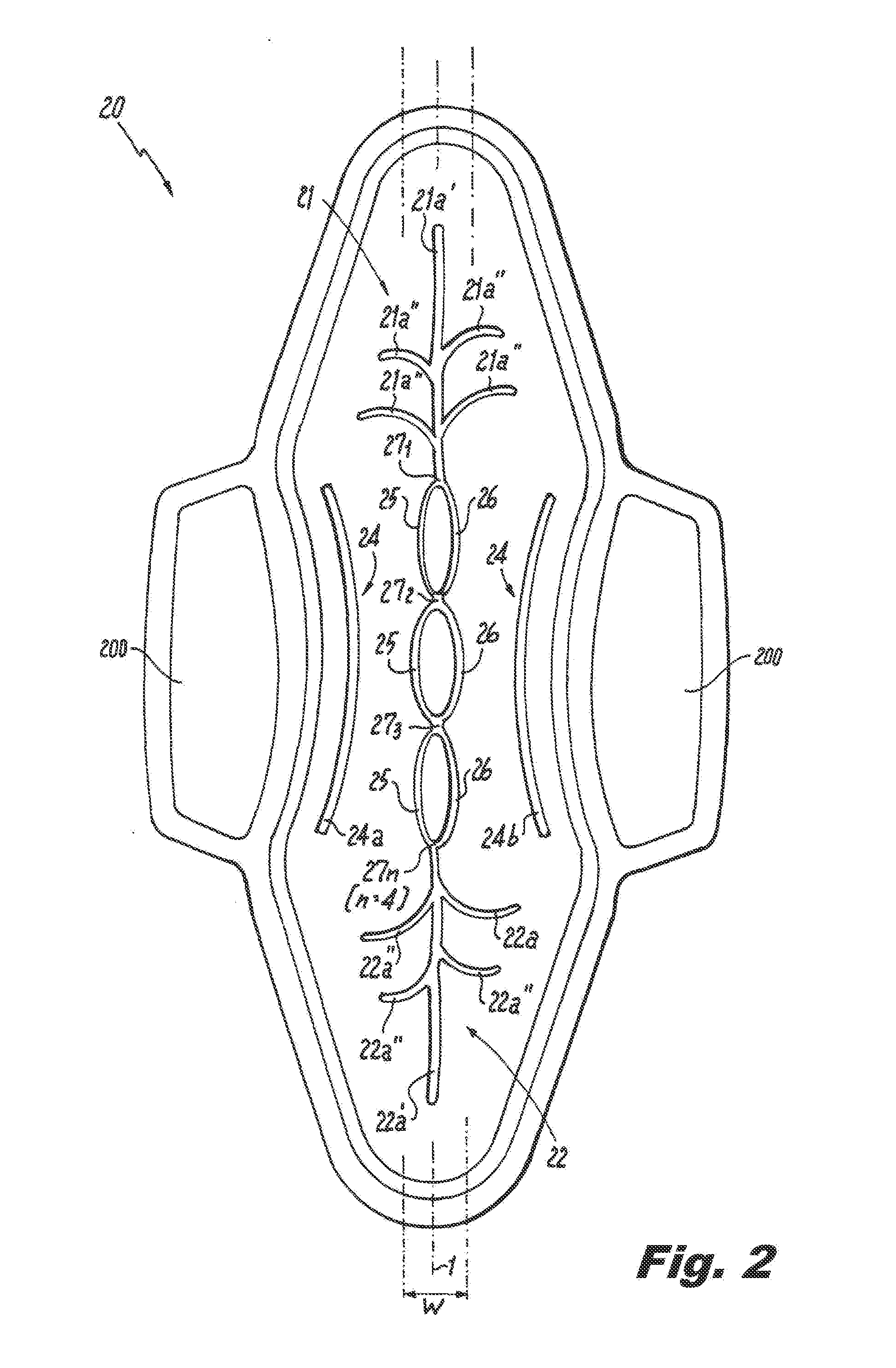 Absorbent article demonstrating controlled deformation and longitudinal fluid distribution