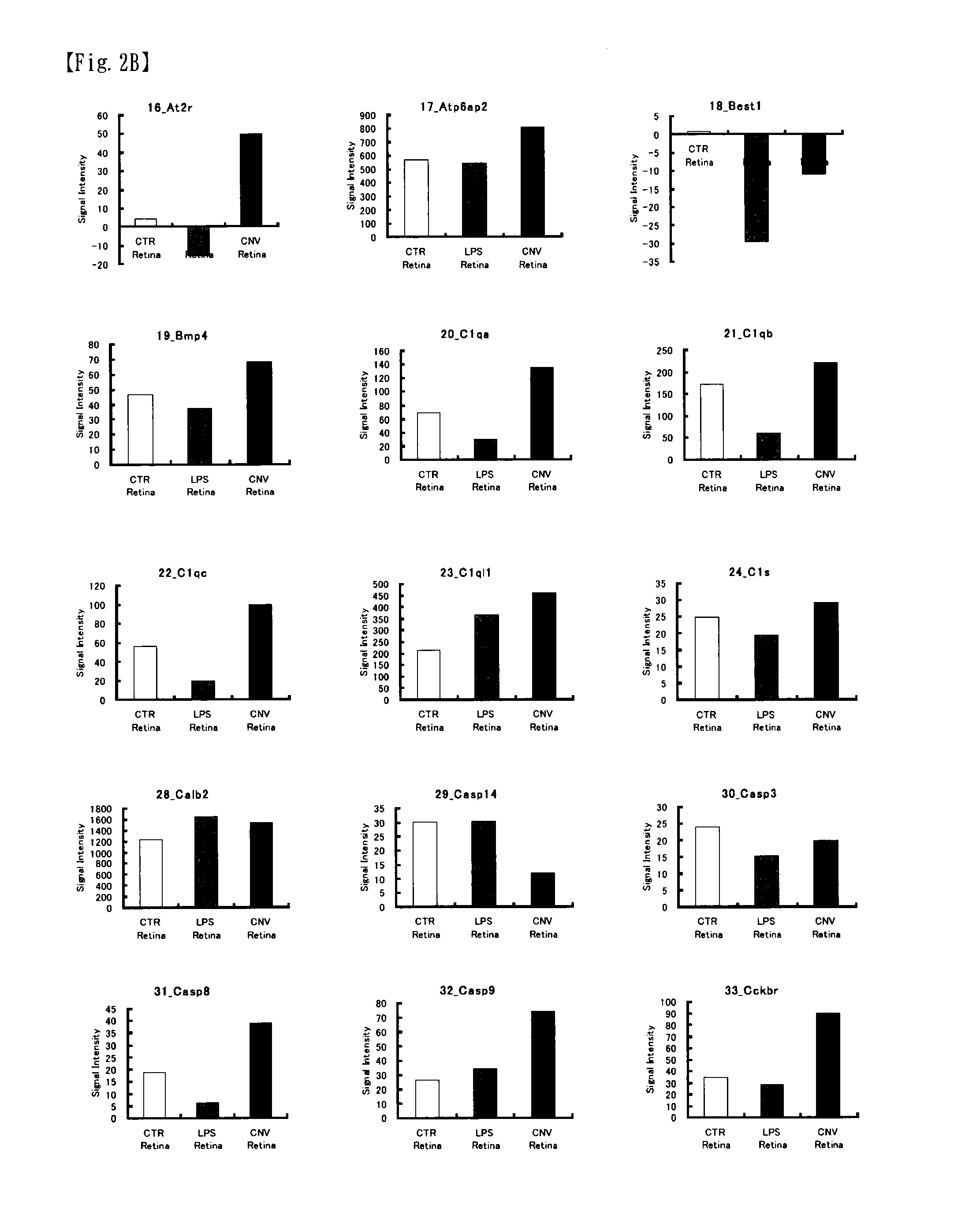 Microarray for evaluating eye disease, and evaluation method of eye disease