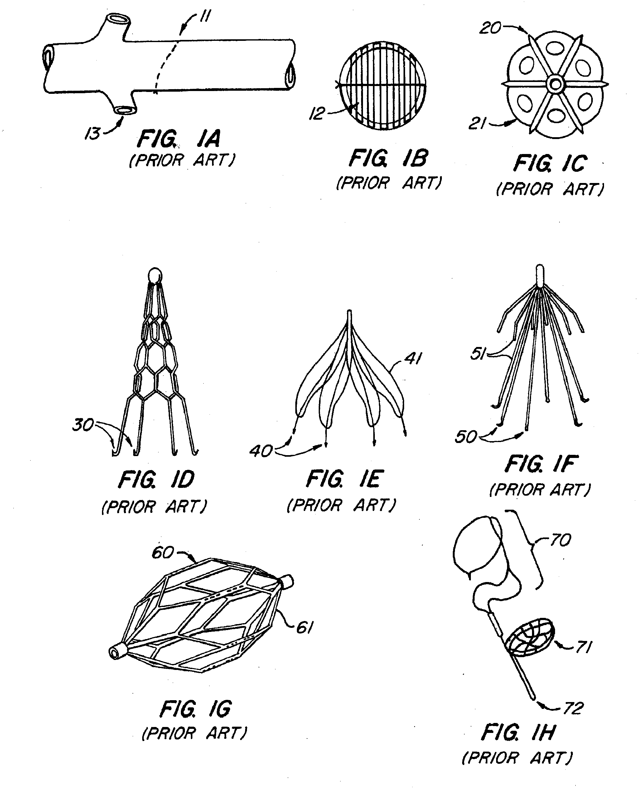 Endoluminal filter