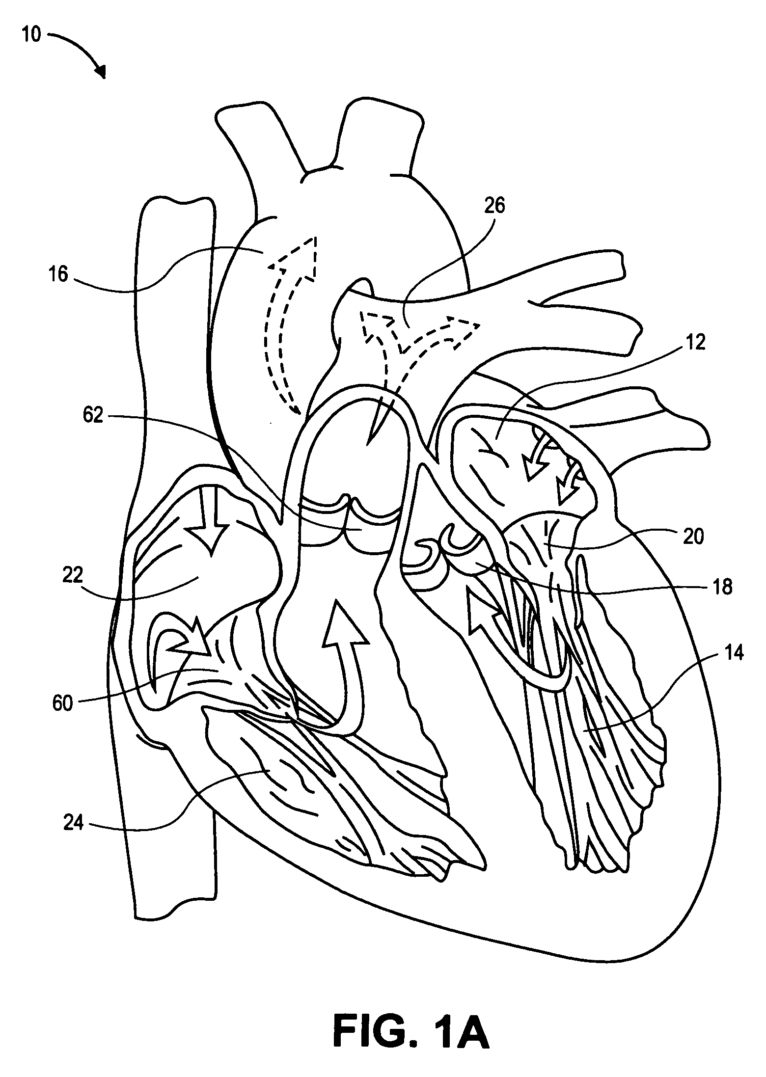 Heart valve chord cutter