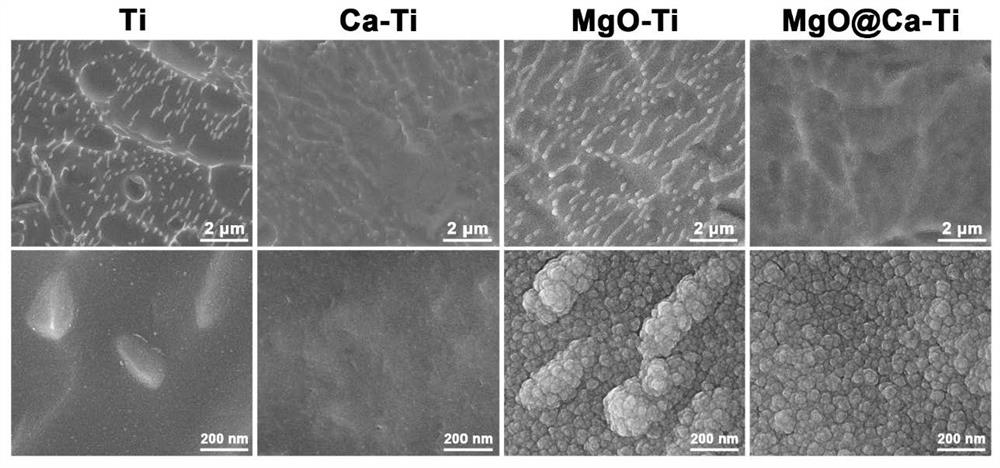 A method for surface modification of titanium-based implant and composite coating on the surface of titanium-based implant