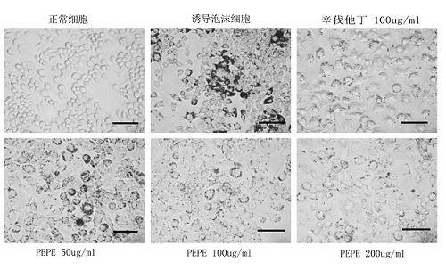 Method for detecting effective hypolipidemic component in edible fungus by establishing foam cell model