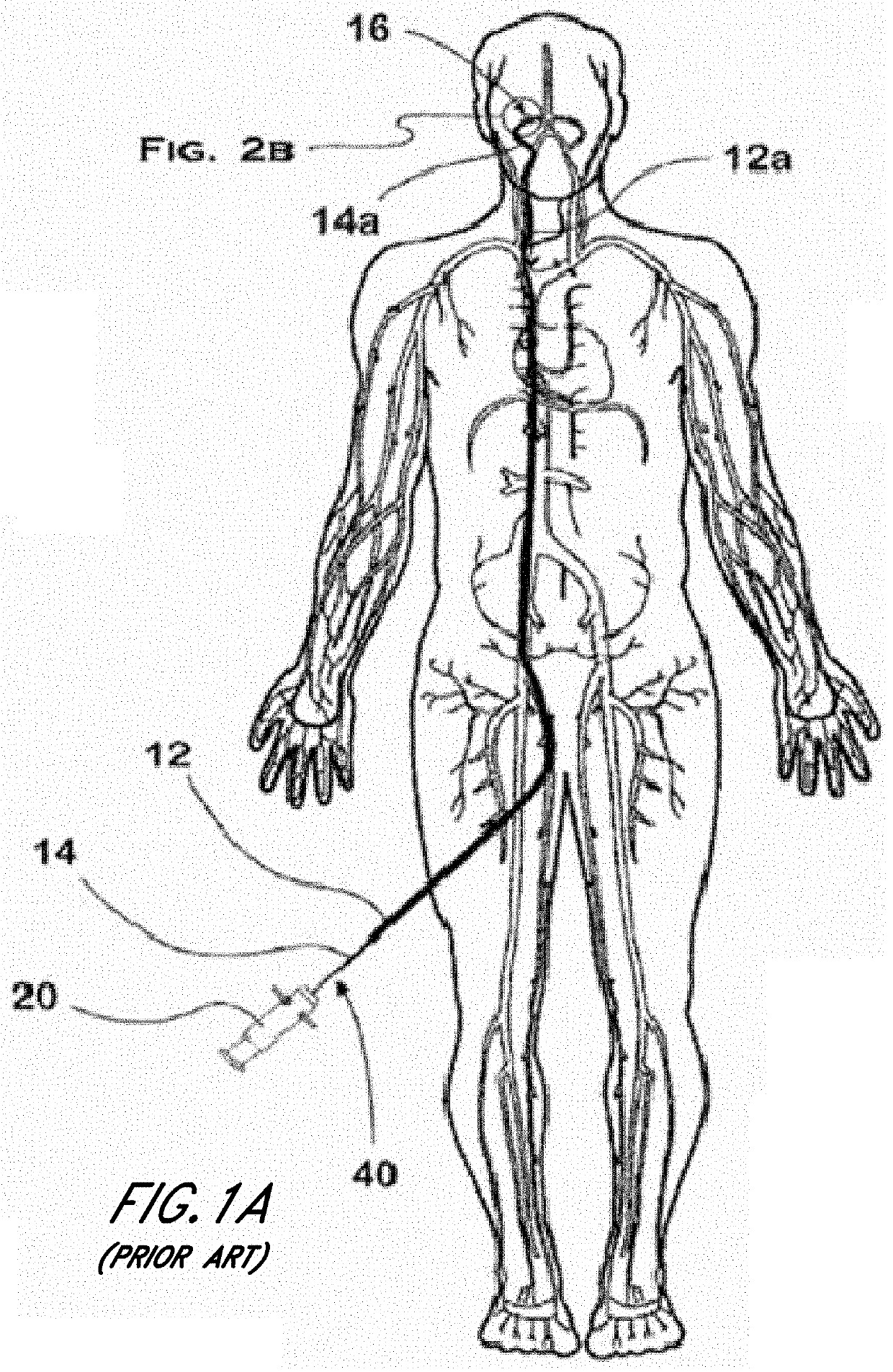 Thromboresistant coatings for aneurysm treatment devices