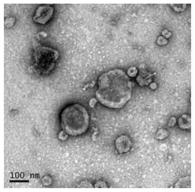 A method for detecting PD-L1 protein on the surface of extracellular vesicles by nucleic acid aptamer of programmed death receptor-ligand 1