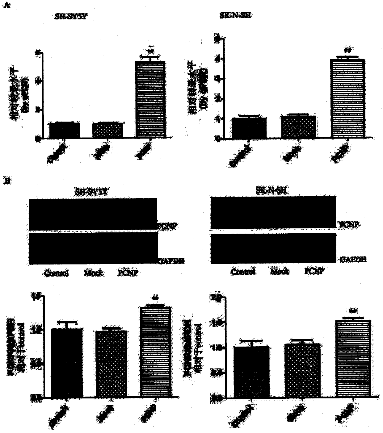 Preparation method and use of medicine over-expressing PCNP gene