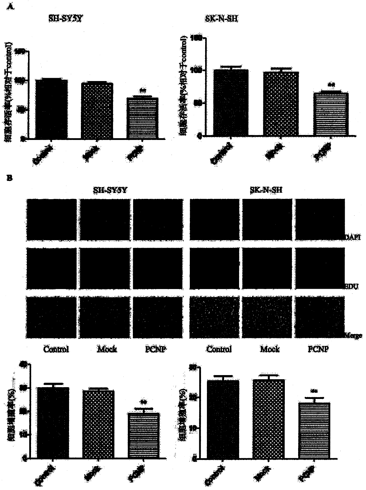 Preparation method and use of medicine over-expressing PCNP gene