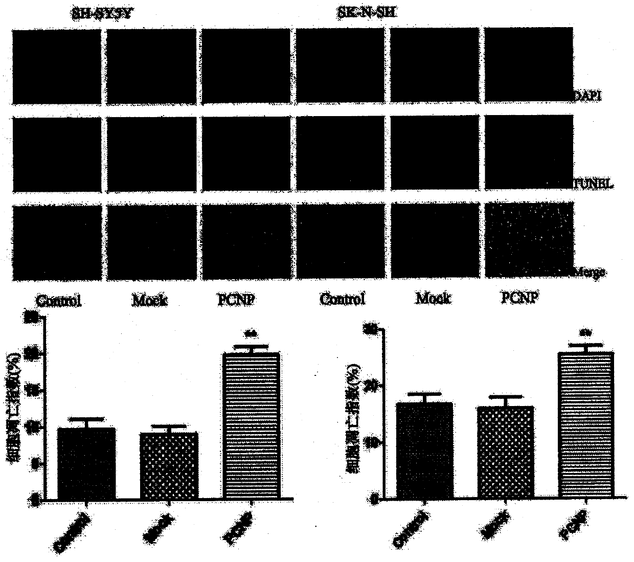 Preparation method and use of medicine over-expressing PCNP gene