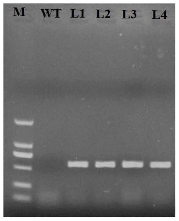 Application of LrWRKY-R2 protein and coding gene thereof in regulation and control of plant stress resistance