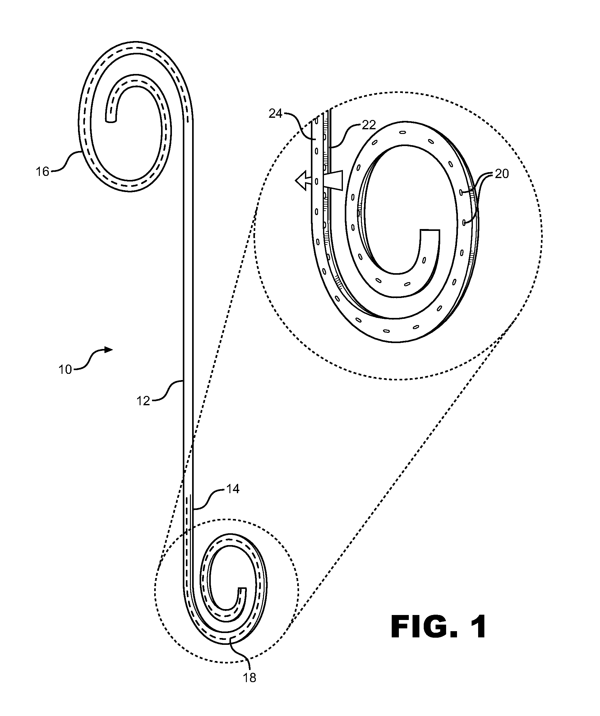 Anti-refluxive and trigone sparing internal ureteral stent