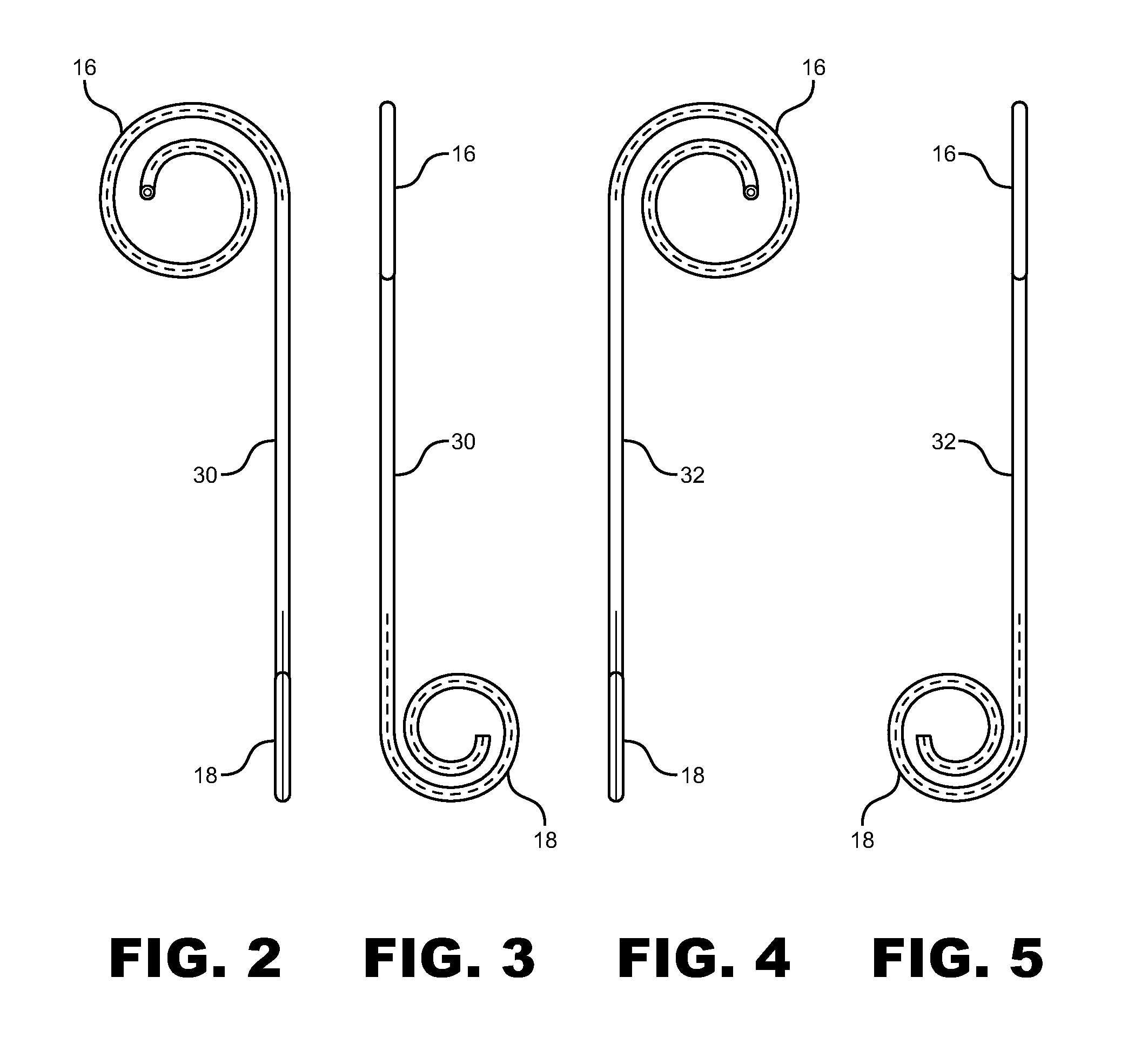 Anti-refluxive and trigone sparing internal ureteral stent