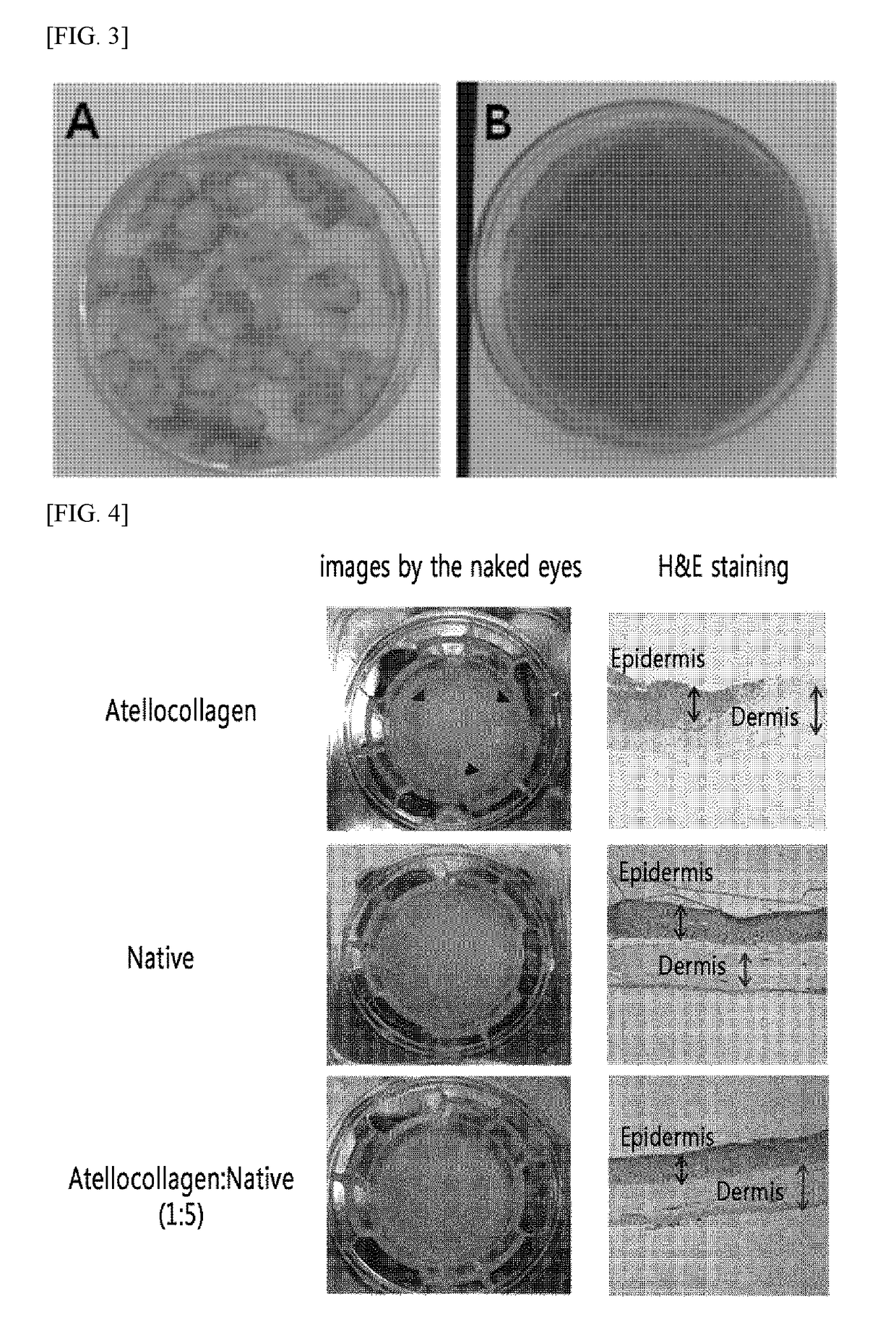 Method for preparing a three-dimensionally cultured skin comprising dermis and epidermis, and the cultured skin made therefrom