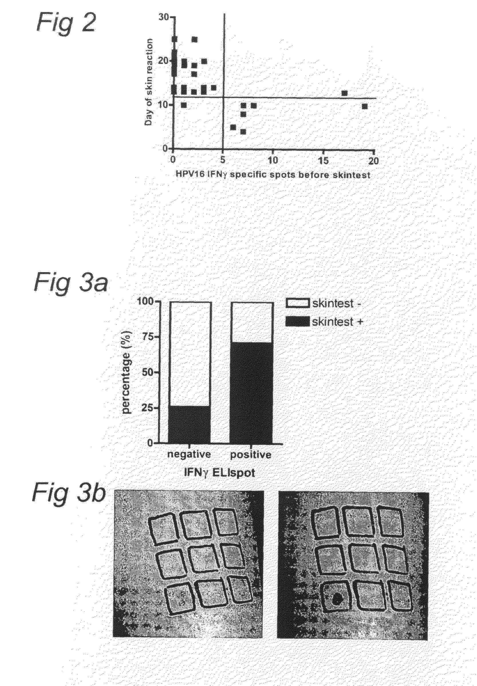 Intradermal HPV peptide vaccination