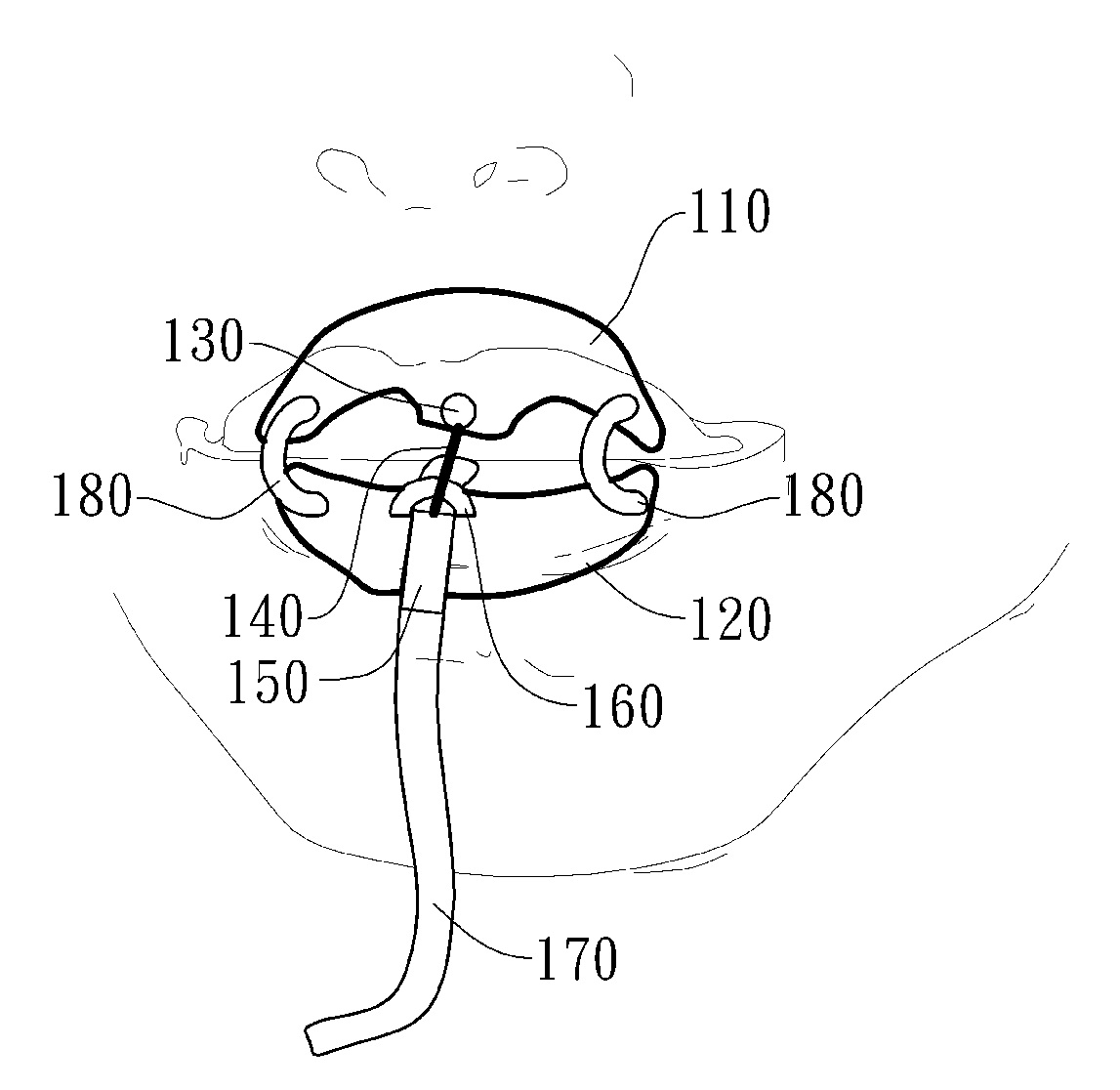 Automated negative pressure oral apparatus