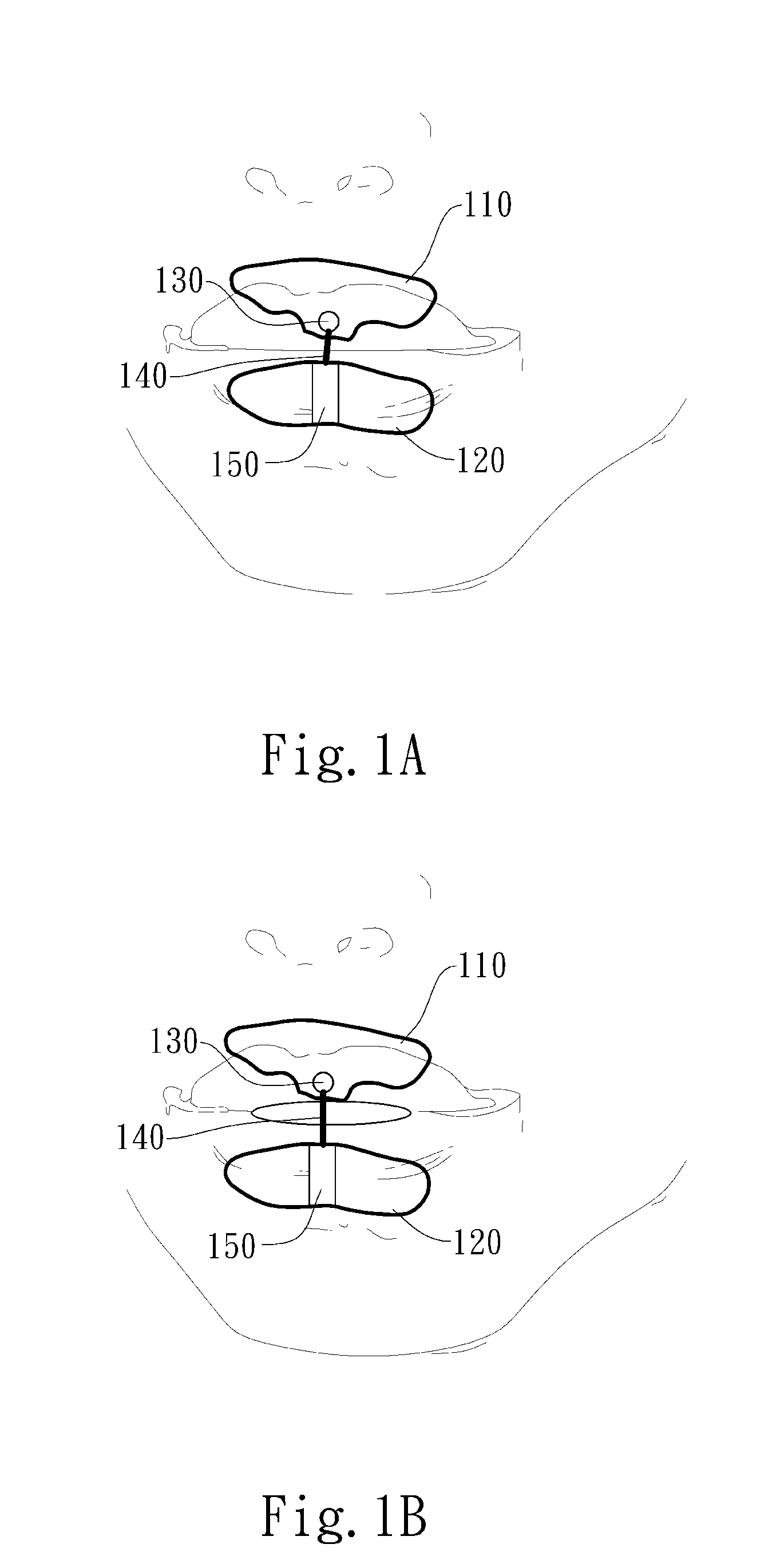 Automated negative pressure oral apparatus