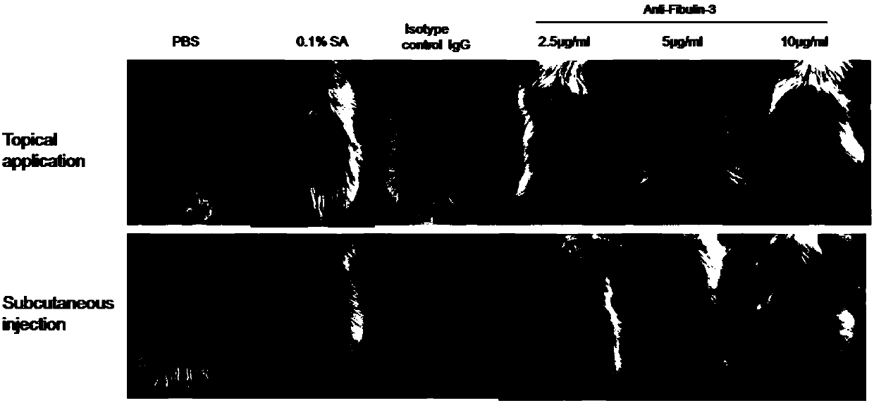 Application of Fibulin-3 taken as target point to prepare medicine for preventing and treating psoriasis