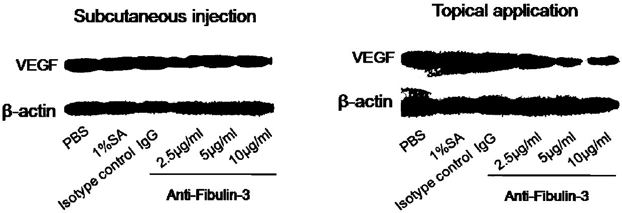 Application of Fibulin-3 taken as target point to prepare medicine for preventing and treating psoriasis