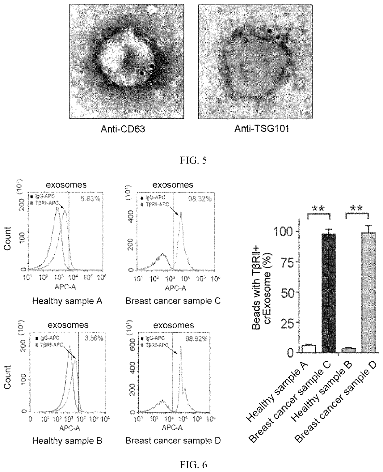 Application of exosome TβRII protein as a marker in the preparation of breast cancer detection kit