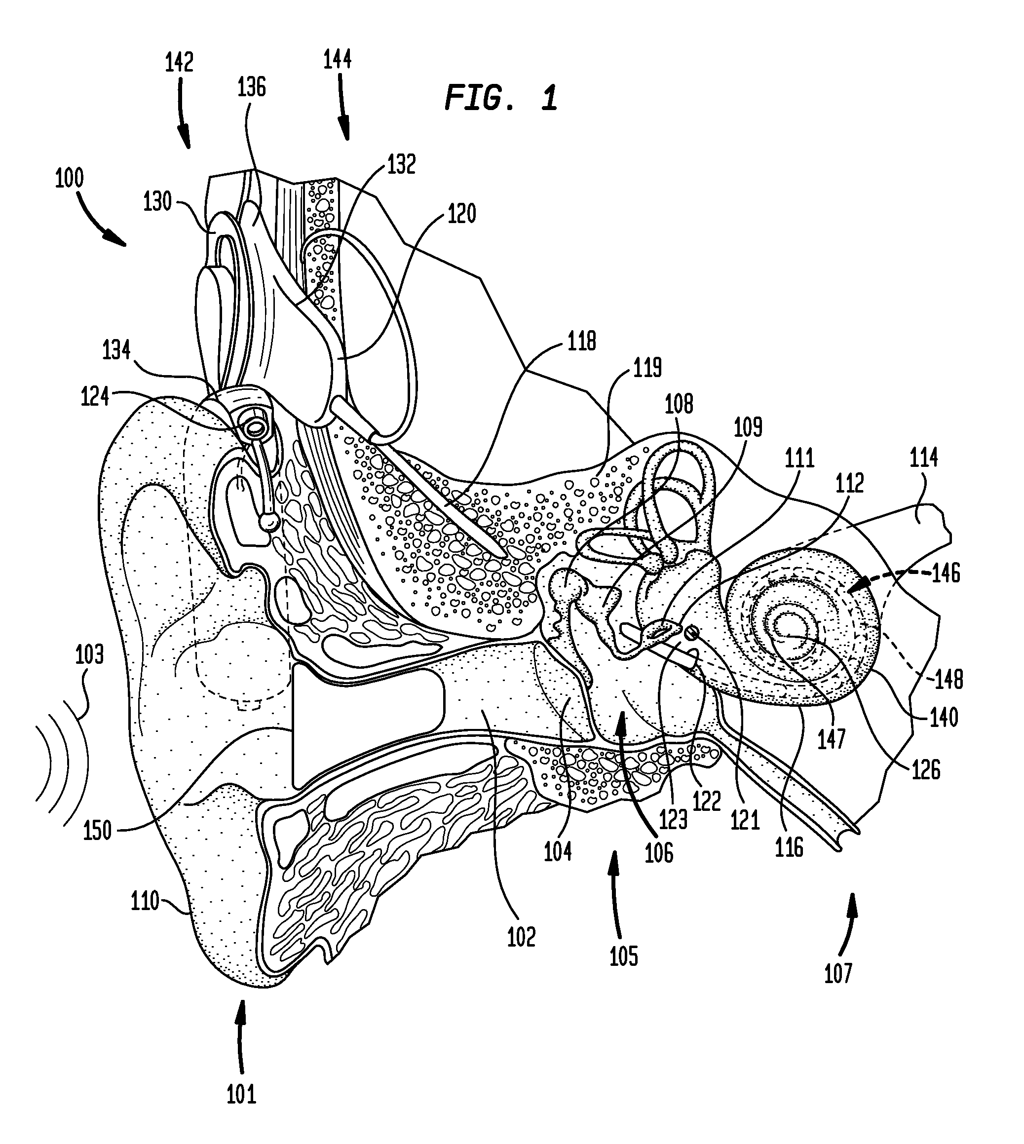 Wireless communication in a multimodal auditory prosthesis