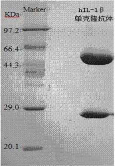 Humanized anti-human-interleukin-1[belta] monoclonal antibody, preparation thereof and applications thereof