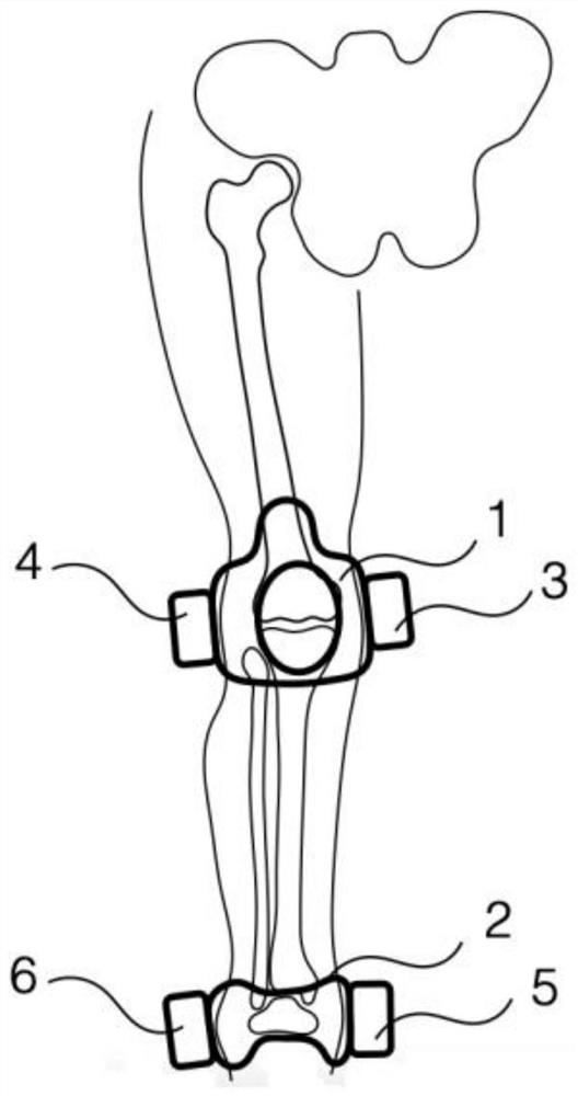 Measurement system and measurement method for lower limb force line angle