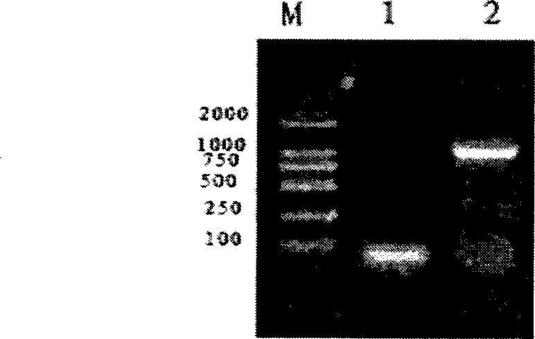 Method for preparing inhibin genetic engineering regulation antigen