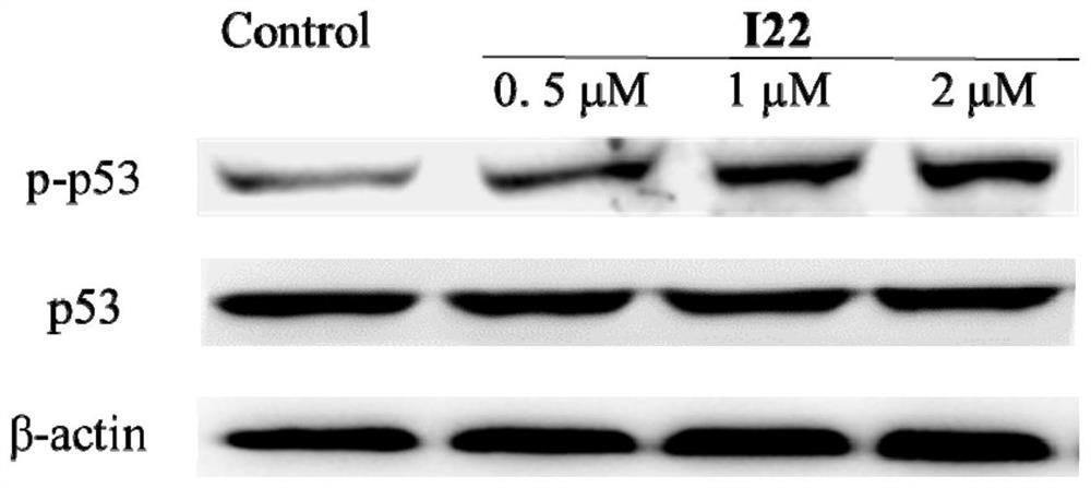 Multi-target anti-tumor small molecule and derivative, preparation method, pharmaceutical composition and application thereof