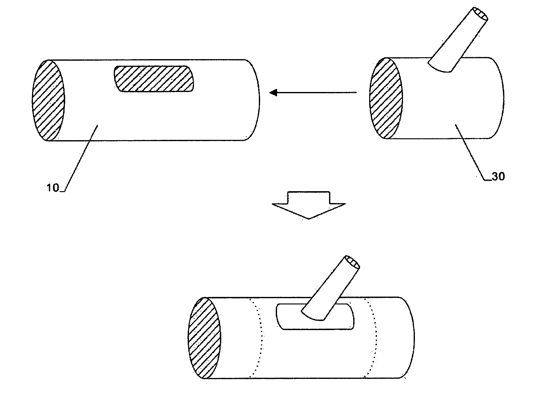 Modular stent graft and delivery system