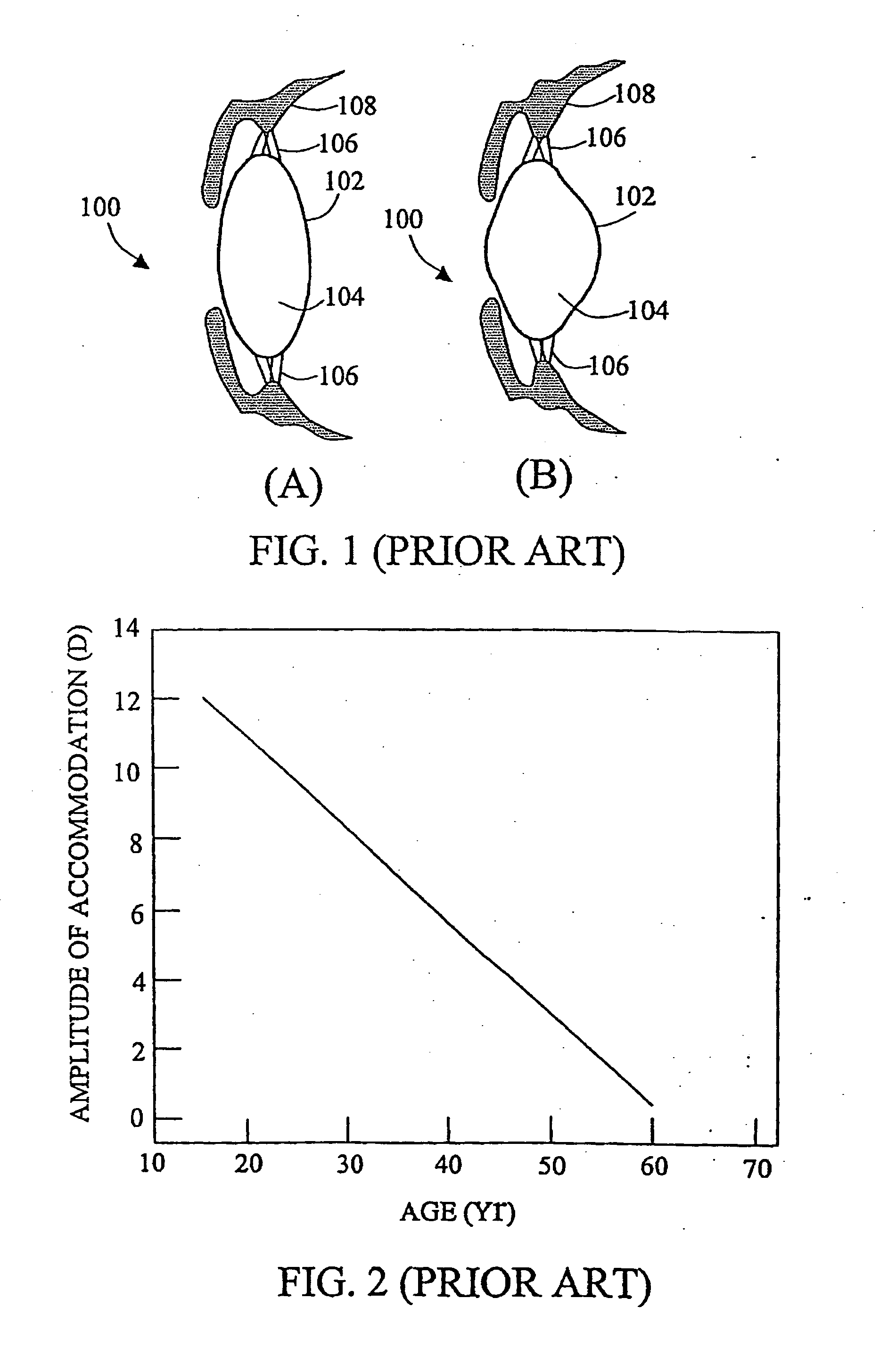 Accommodative intraocular lens