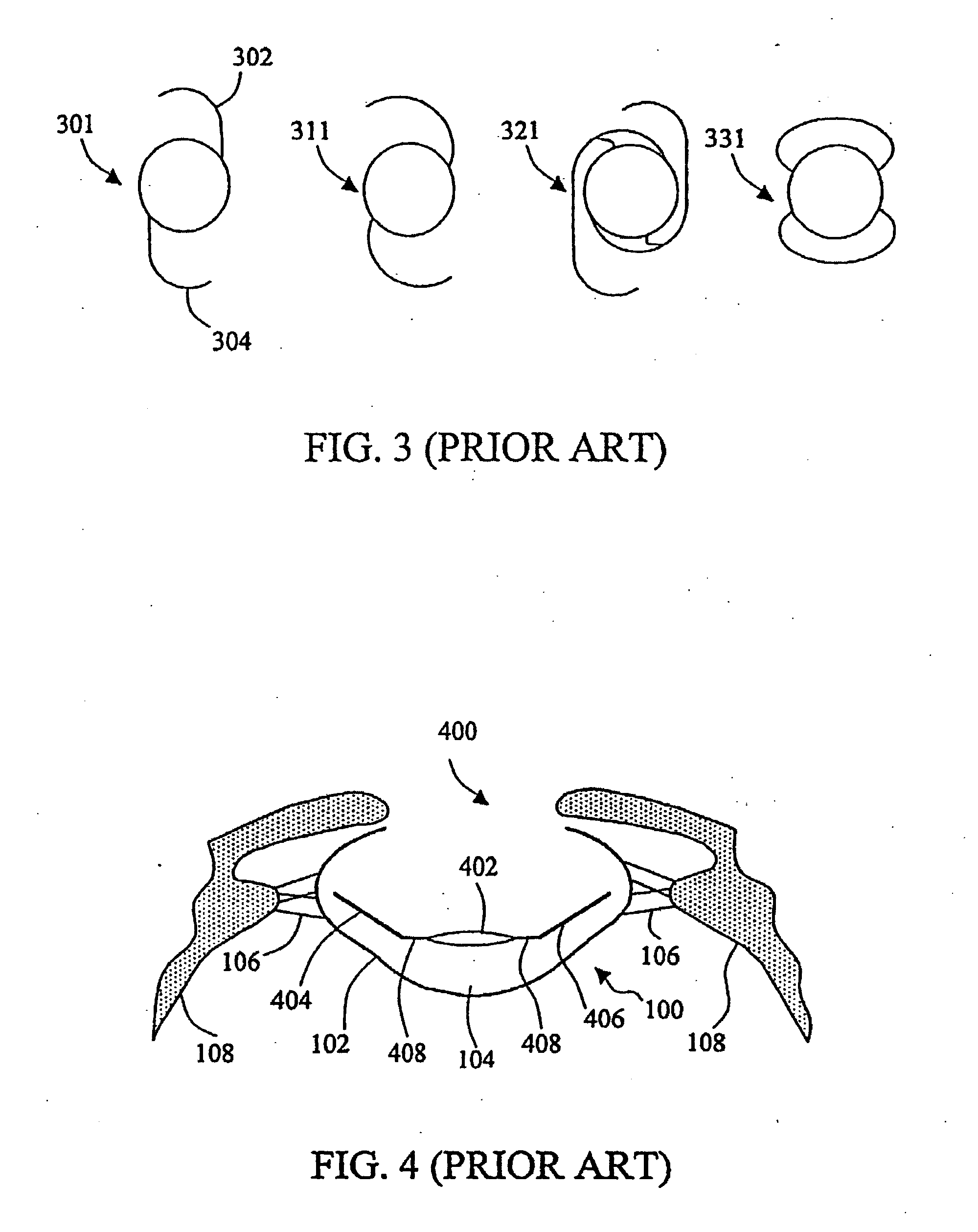 Accommodative intraocular lens