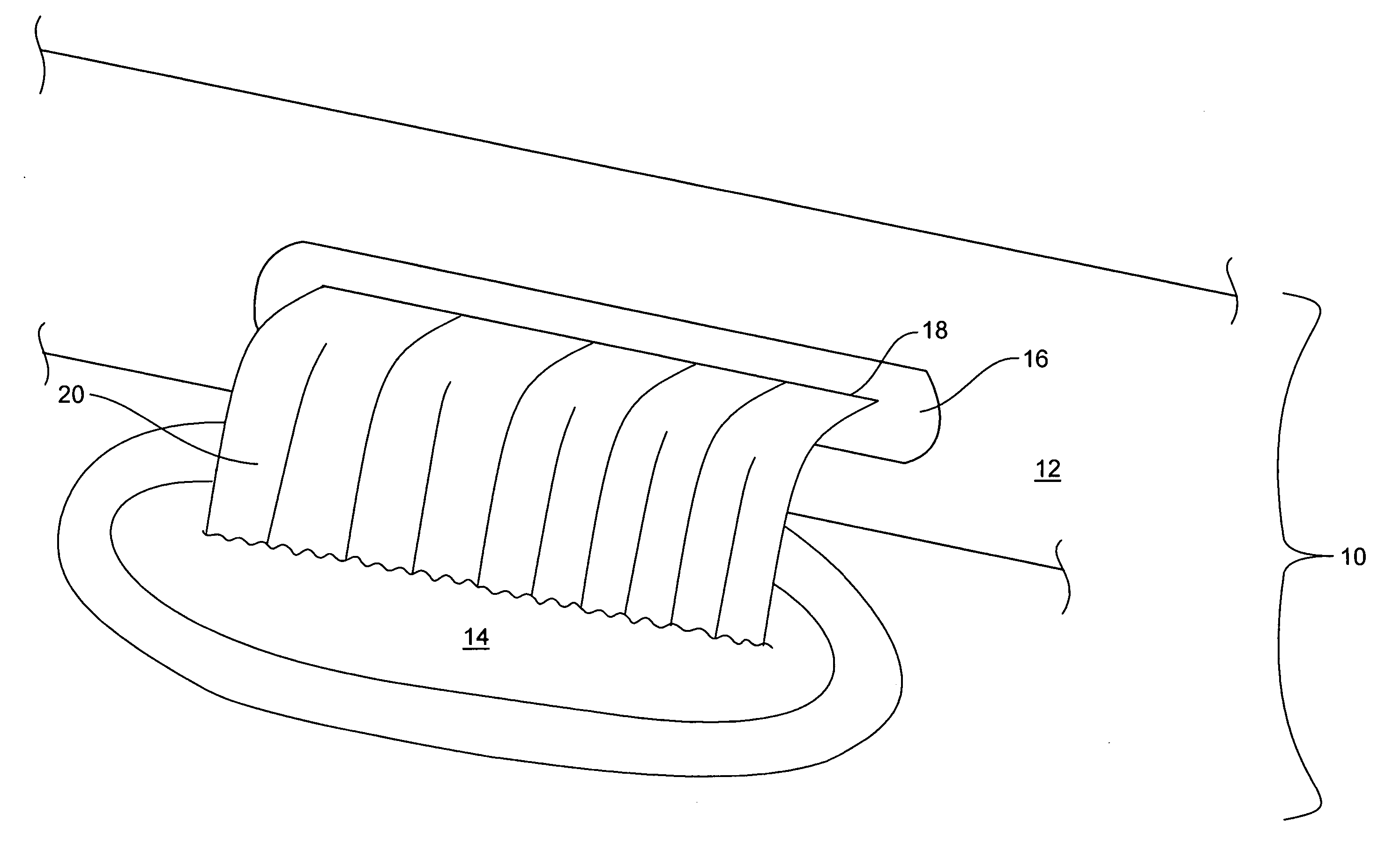 Waterfall waterjet with debris removing outlet