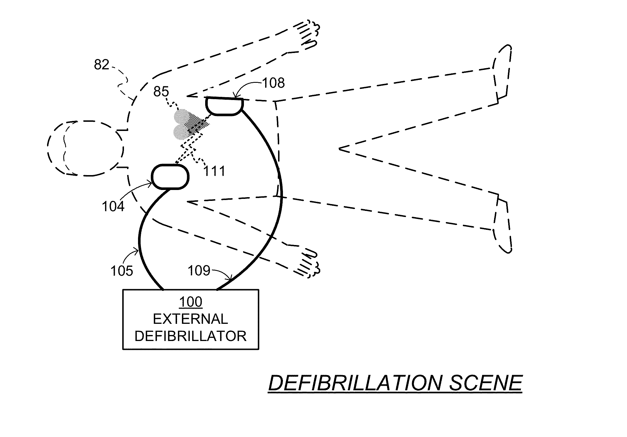 System and method for electrocardiogram analysis and optimization of cardiopulmonary resuscitation and therapy delivery