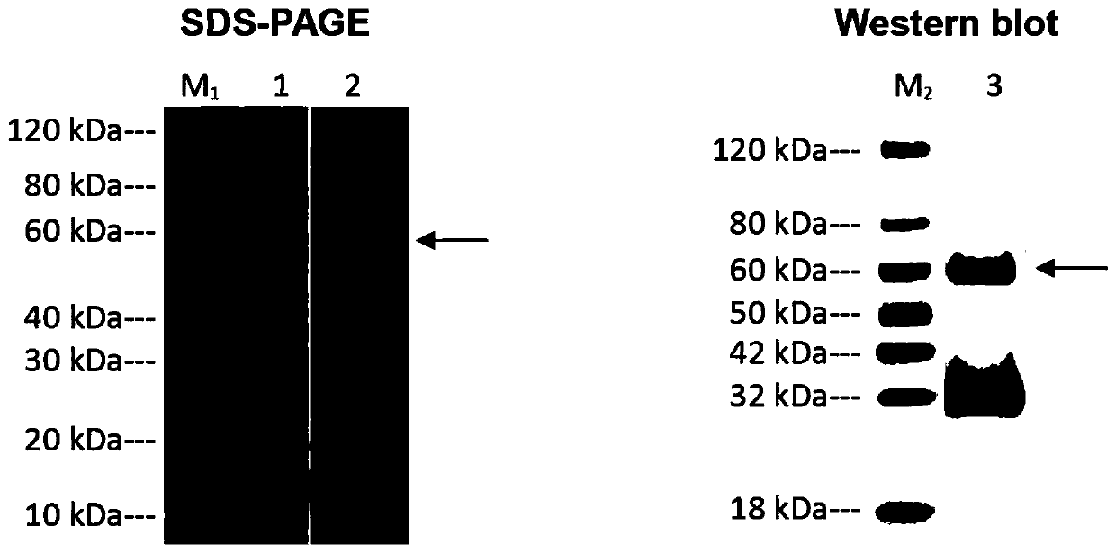 Anti-ANGPTL3 (angiopoietin-like protein) monoclonal antibody and purpose thereof in preparing medicine capable of treating nephrotic syndrome