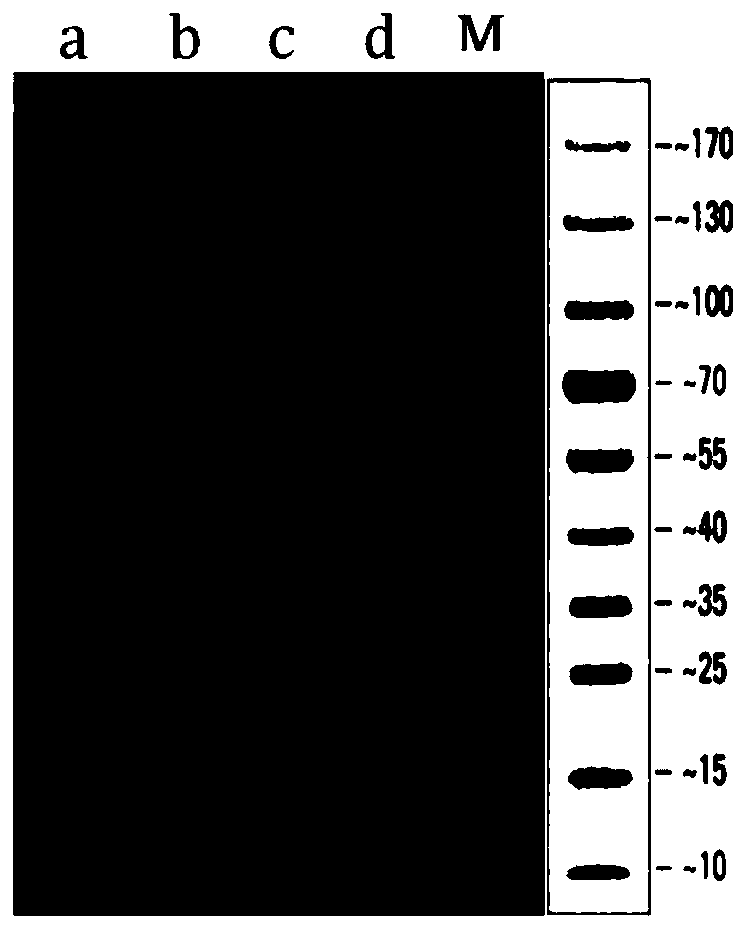 Anti-ANGPTL3 (angiopoietin-like protein) monoclonal antibody and purpose thereof in preparing medicine capable of treating nephrotic syndrome