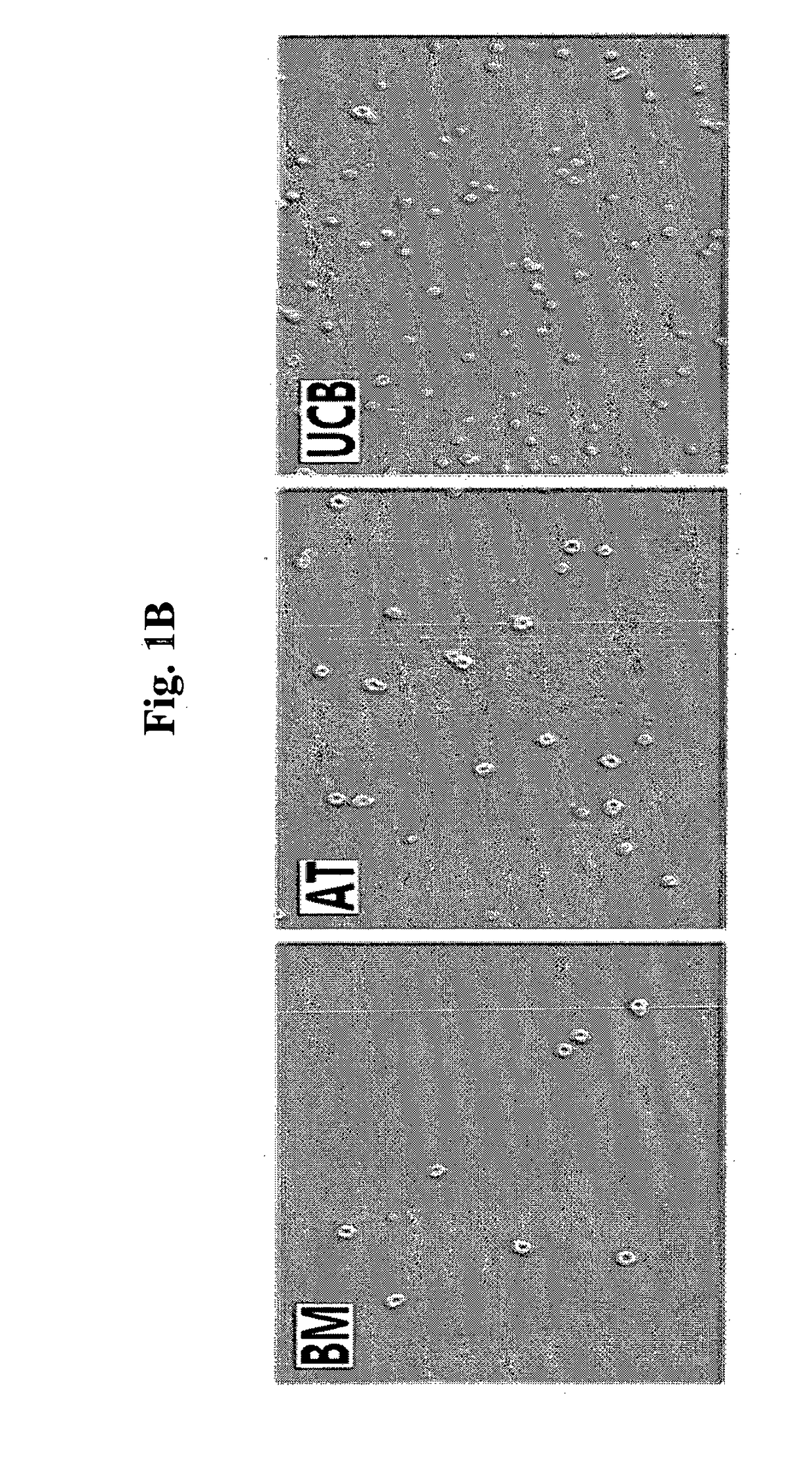 Pharmaceutical composition for the prevention or treatment of a pulmonary disorder comprising mesenchymal stem cells having improved proliferation and differentiation capacity