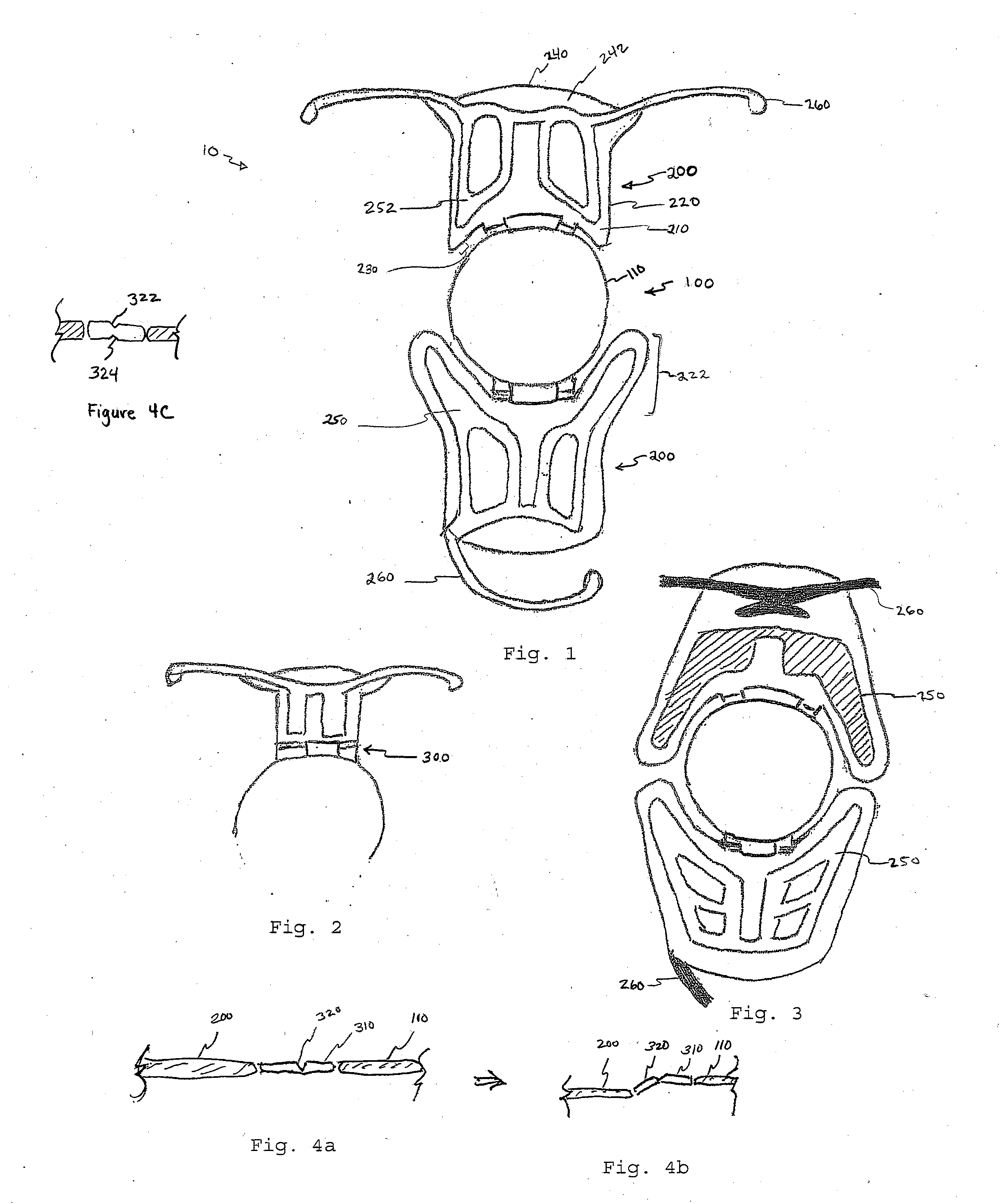 Accommodating Intraocular Lens