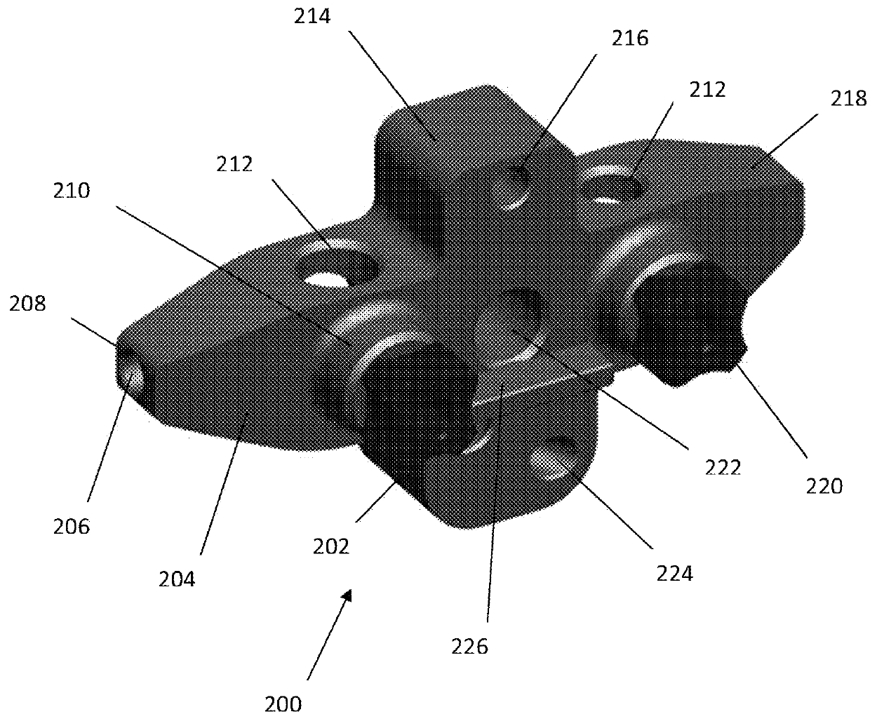 Anatomically guided instrumentation for trochlear groove replacement