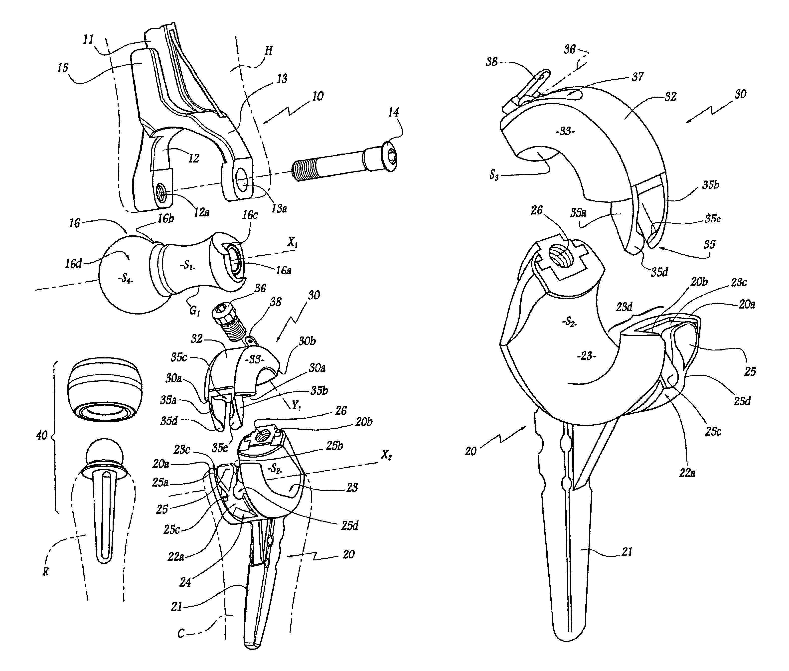 Elbow prosthesis