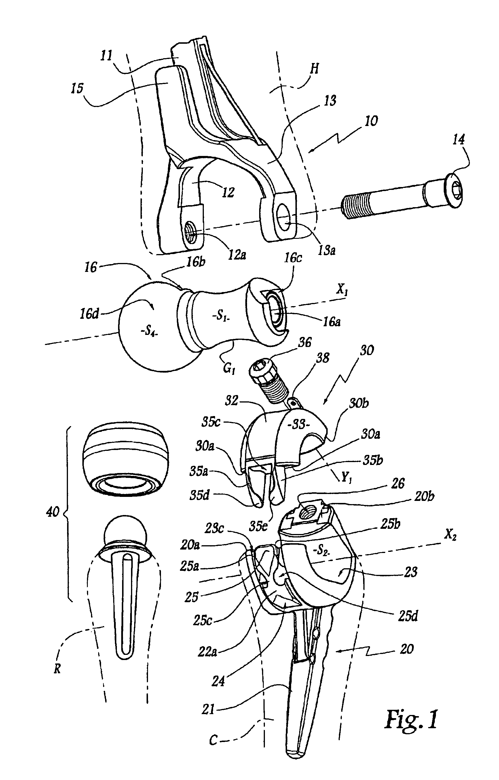 Elbow prosthesis