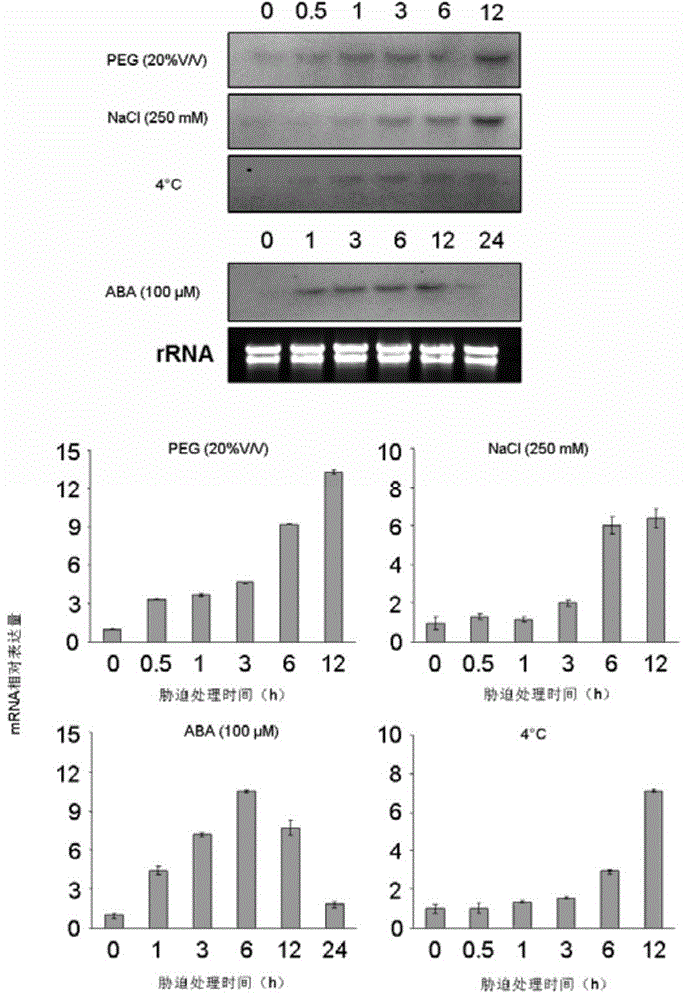 Transcription factor SiARDP for conditioning resilience resistance of rice and encoding gene and application of transcription factor SiARDP