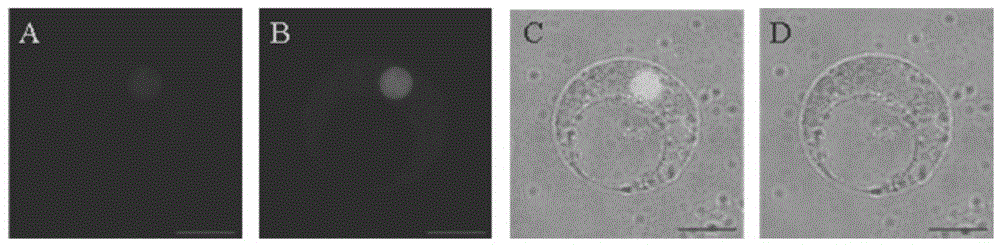 Transcription factor SiARDP for conditioning resilience resistance of rice and encoding gene and application of transcription factor SiARDP