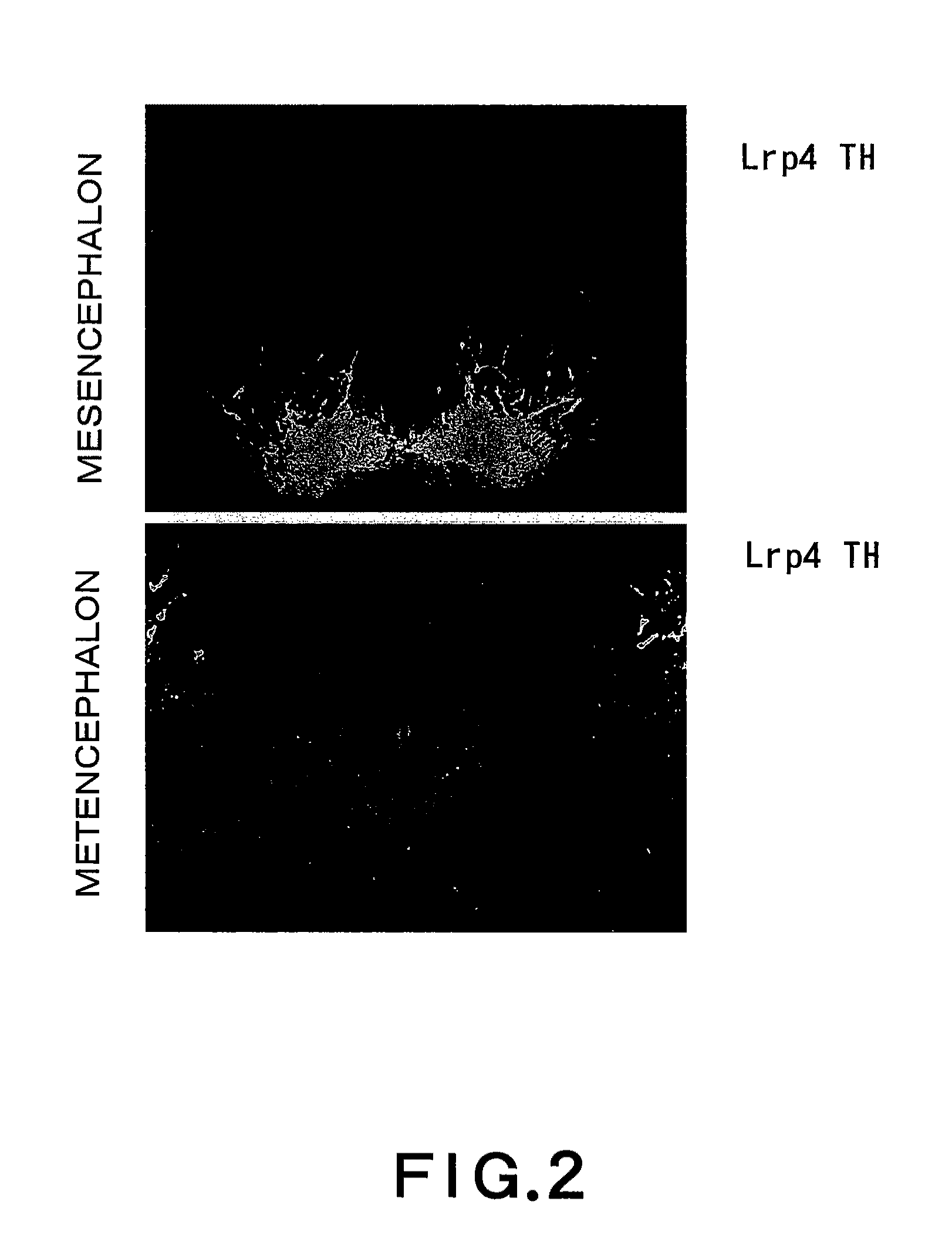 Dopaminergic neuron progenitor cell marker 187A5