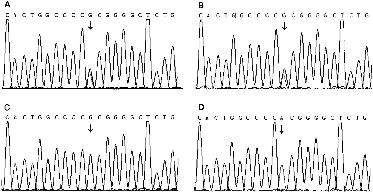 Primers and kits for detecting polymorphic sites of asthma susceptible genes ALOX5 (Arachidonate 5-Lipoxygenase), LTA4H (Leukotriene A4Hydrolase) and LTC4S (Leukotriene C4Synthase), and application of primers and kits