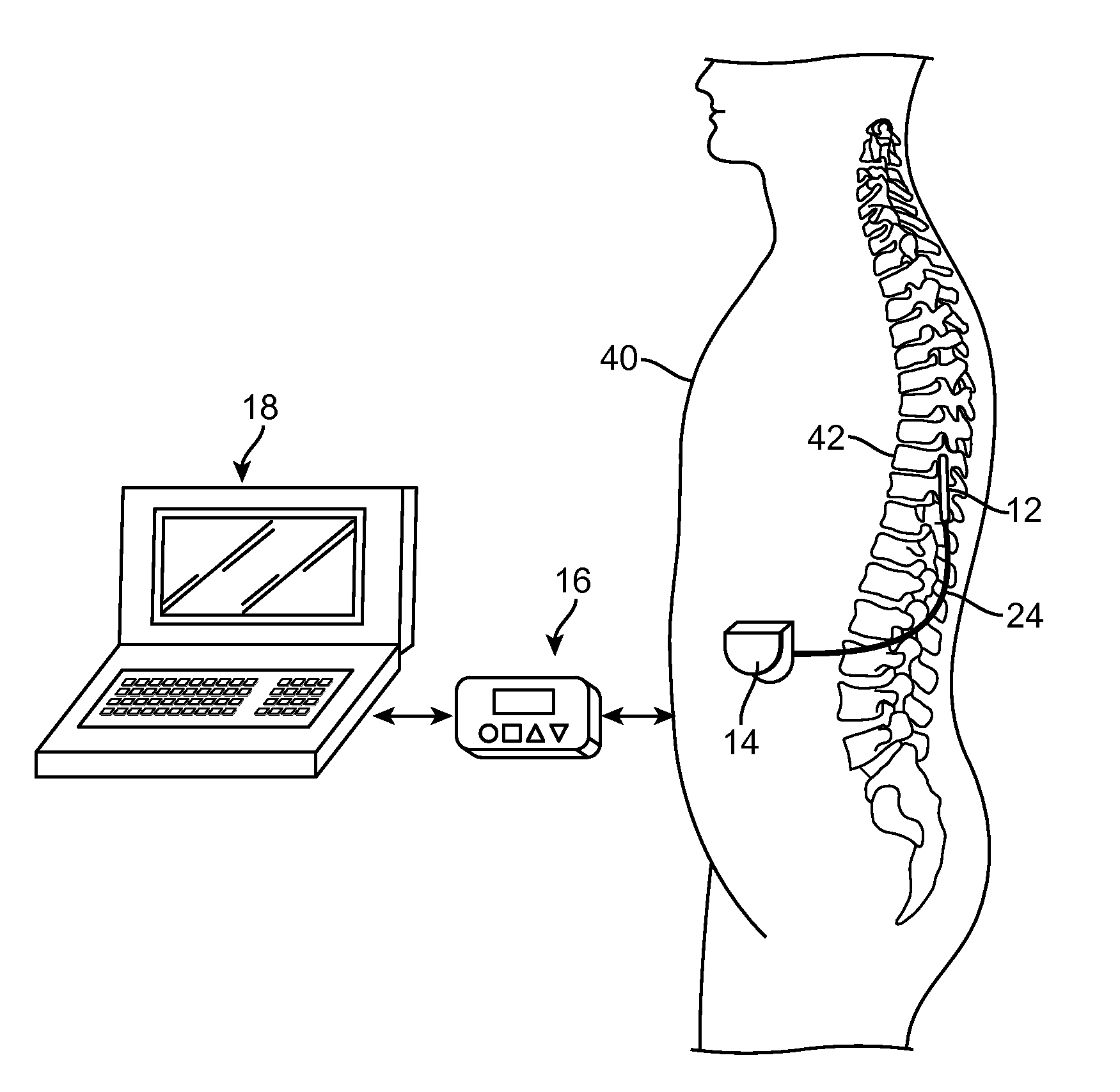 Field augmented current steering using voltage sources