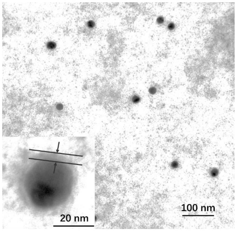 Bacterial outer membrane vesicle coated supramolecular nanoparticle precursor, application and drug loading system