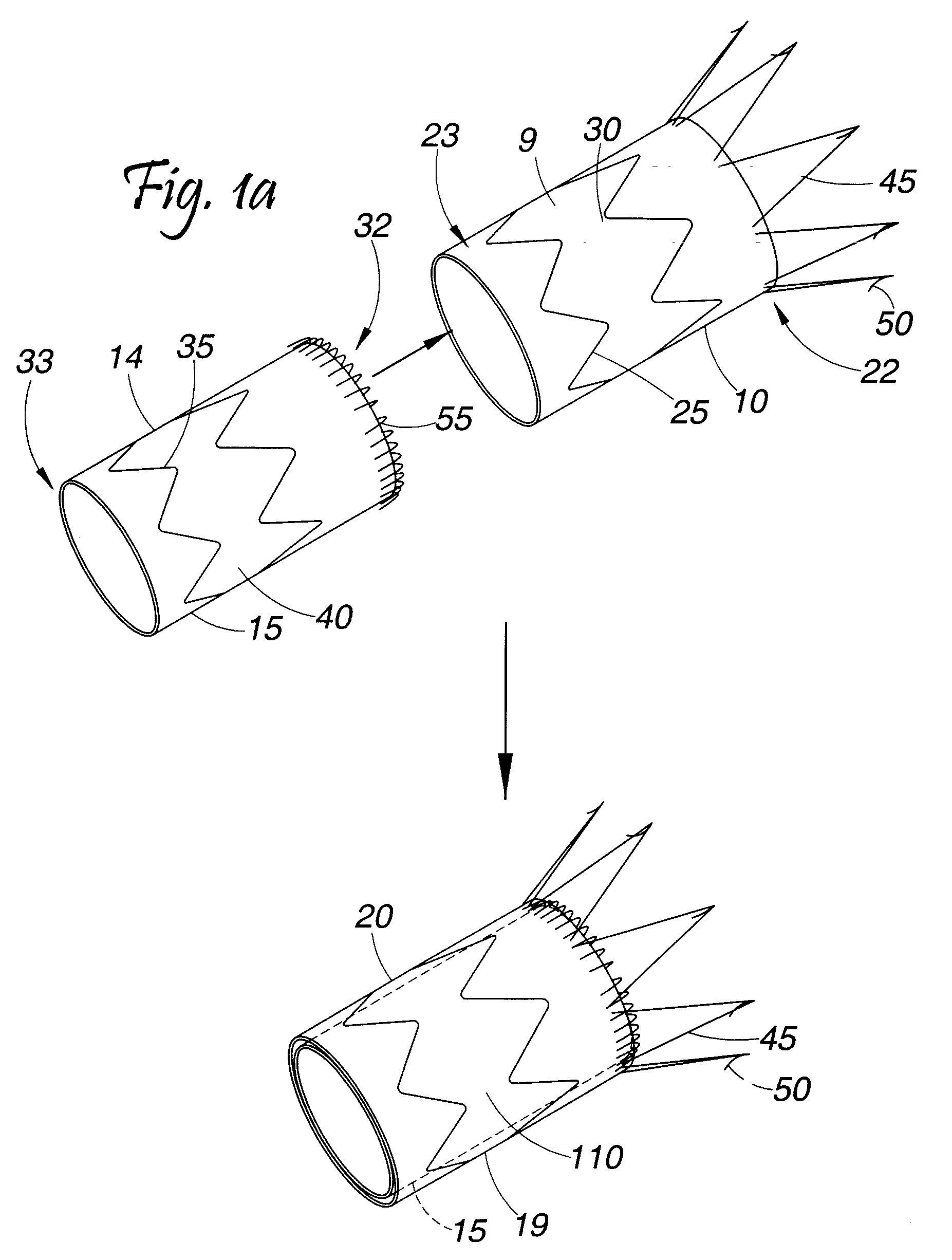 Composite Stent Graft