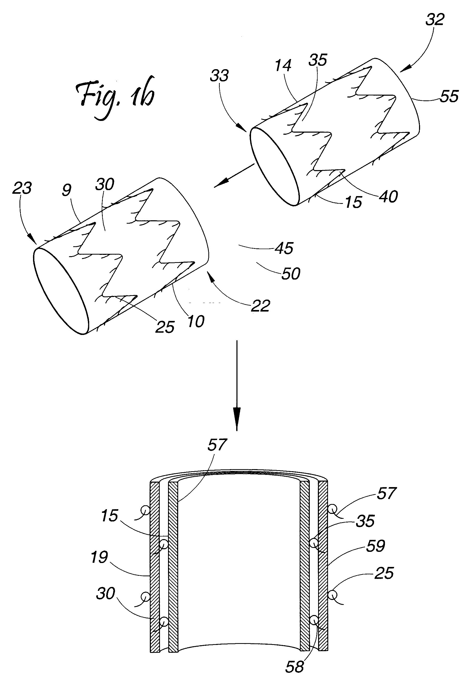 Composite Stent Graft