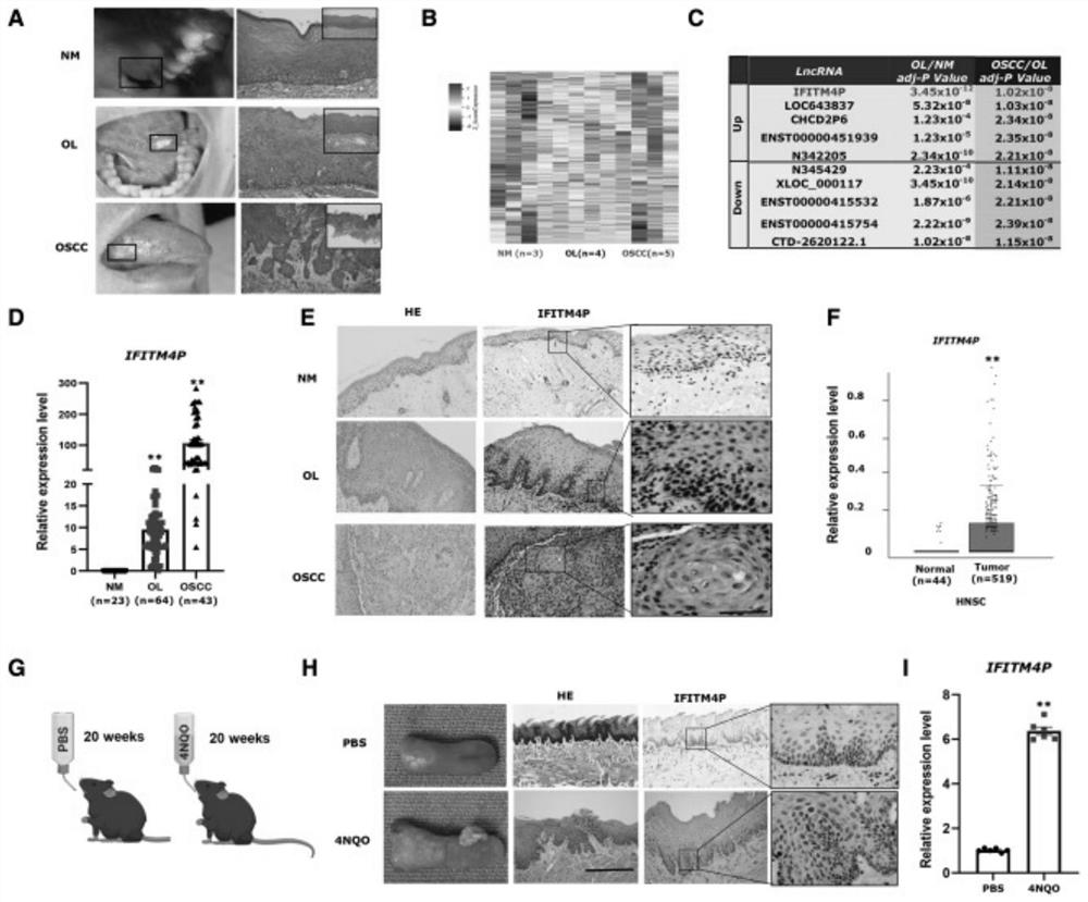 Application of LncRNA IFITM4P as molecular marker in oral leukoplakia and/or oral cancer