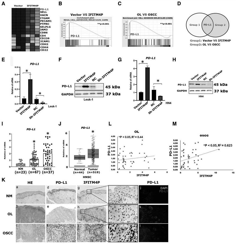 Application of LncRNA IFITM4P as molecular marker in oral leukoplakia and/or oral cancer