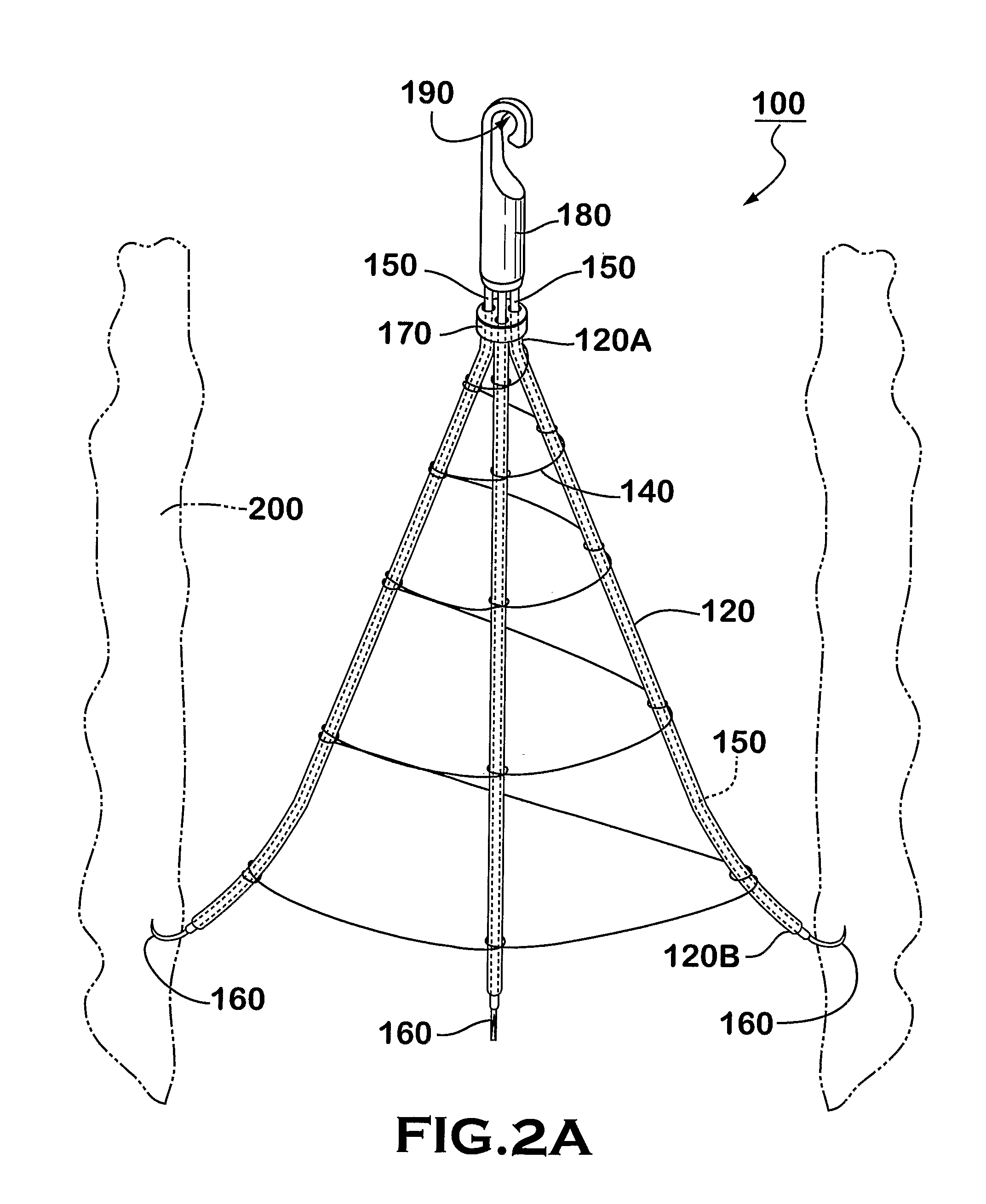 Helical Vena Cava Filter